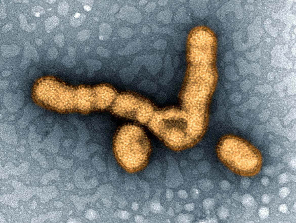H1N1 flu virus particles