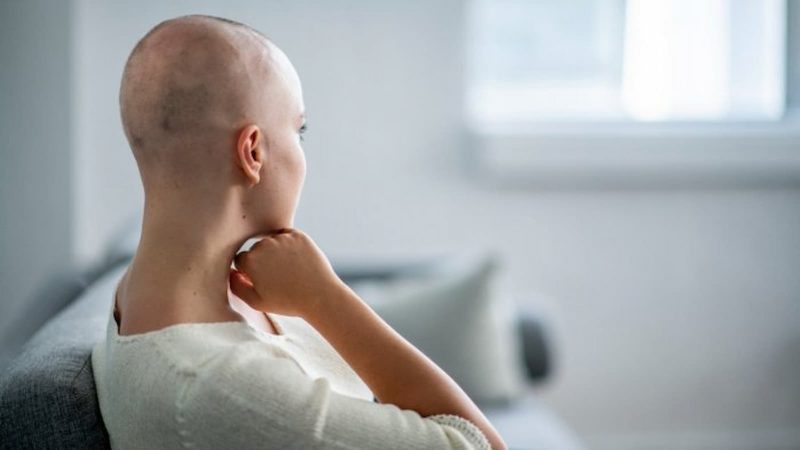 what-is-alopecia
